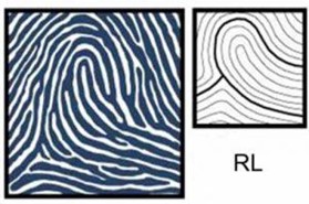Chủng vân tay đặc biệt Radial Loop (RL) - ảnh minh họa.